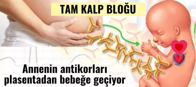 Tam kalp bloğu ve Lupus